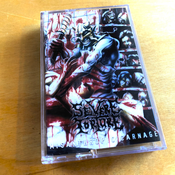 Severe Torture - Misanthropic Carnage Cassette