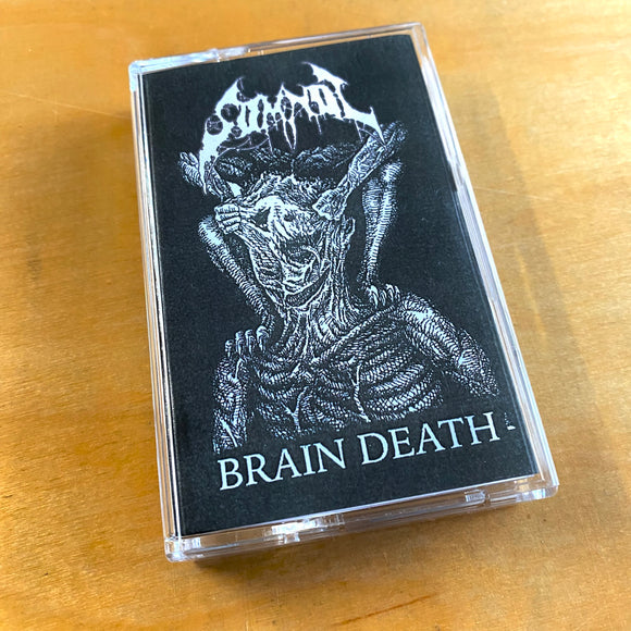 USED - Somnol – Brain Death Cassette