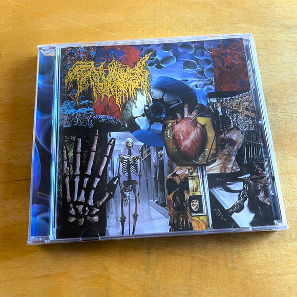Trichomoniasis - Harvest Of The Killing Fields CD