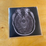 Ed Chang's Blindfold Deluxxxe – Live At Salon Zwerge CD