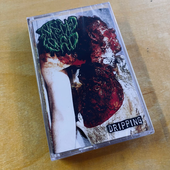 Infected Load - Dripping Cassette