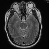 Ed Chang's Blindfold Deluxxxe – Live At Salon Zwerge CD