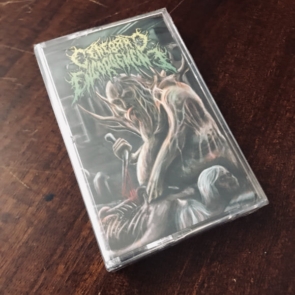 Cerebral Engorgement - Gastrointestinal Bleeding Cassette
