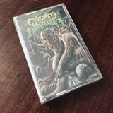 Cerebral Engorgement - Gastrointestinal Bleeding Cassette
